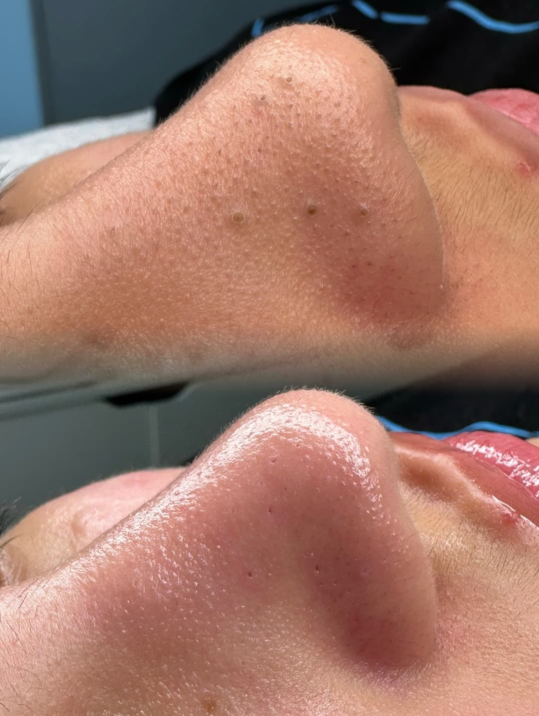 Nega lica i depilacija — LAEL Beauty, Mladenovac, fotografija 20