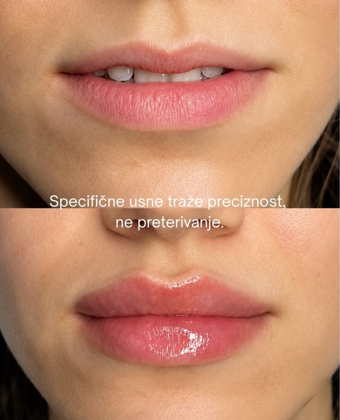 Nega lica i depilacija — LAEL Beauty, Mladenovac, fotografija 10
