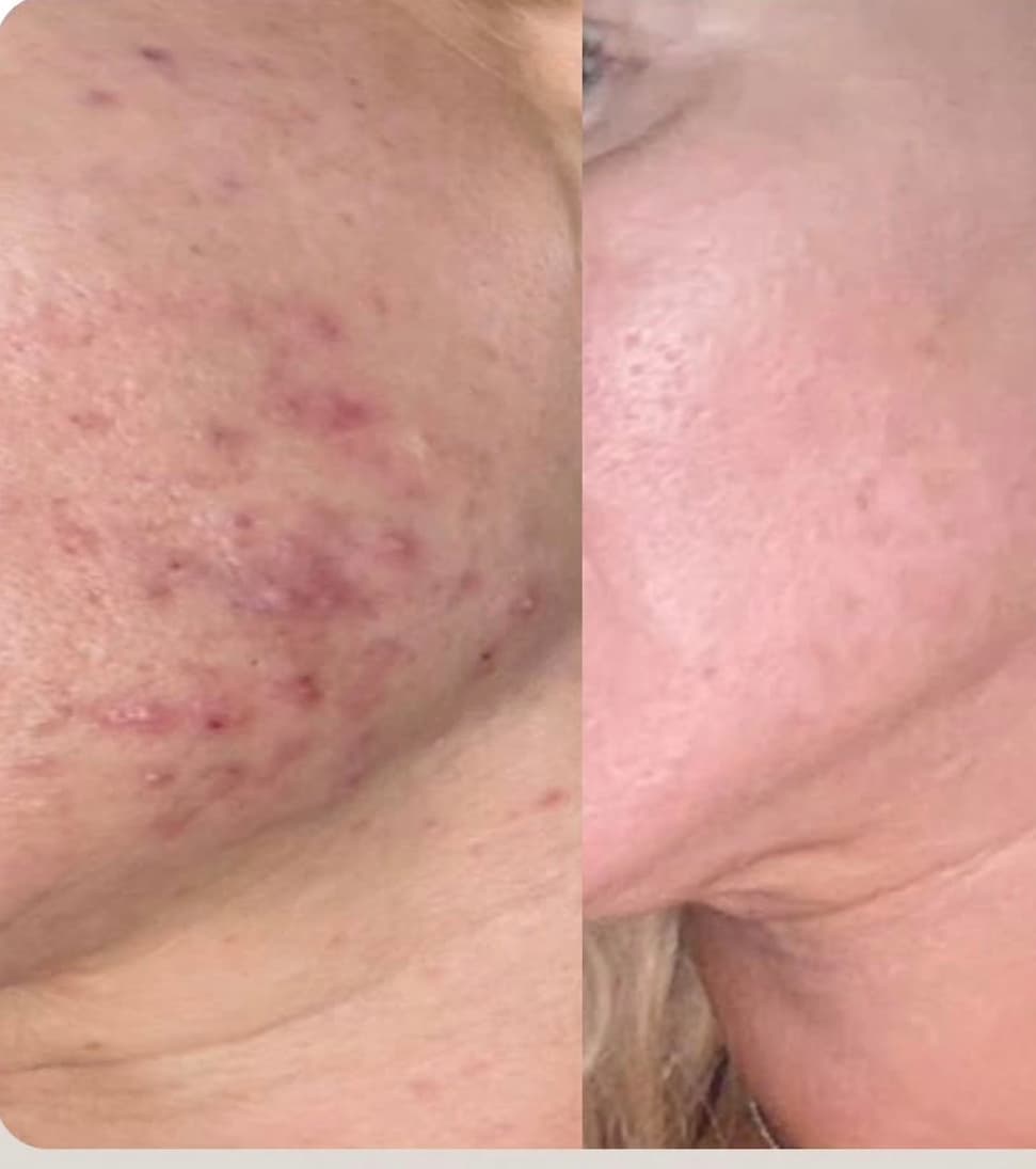 Nega lica i depilacija — LAEL Beauty, Mladenovac, fotografija 21