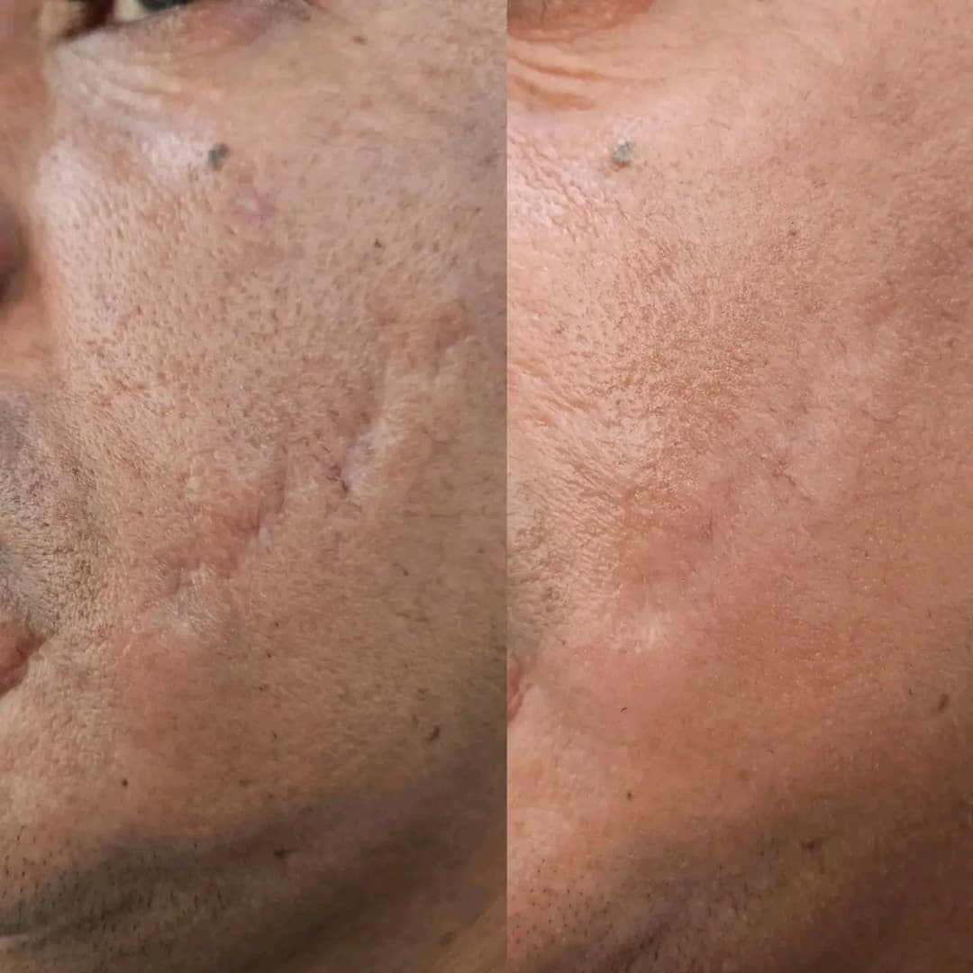 Nega lica i depilacija — LAEL Beauty, Mladenovac, fotografija 11