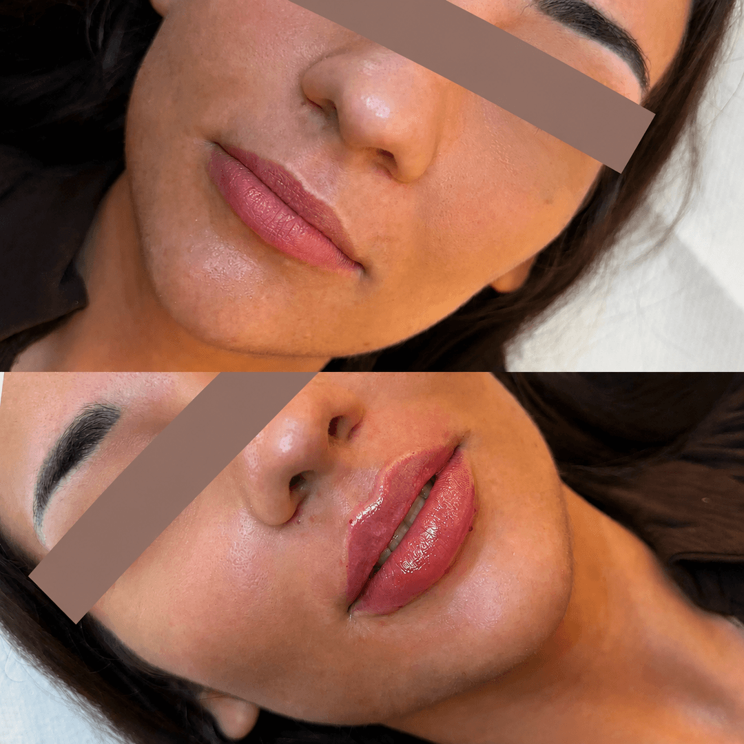 Nega lica i depilacija — LAEL Beauty, Mladenovac, fotografija 19