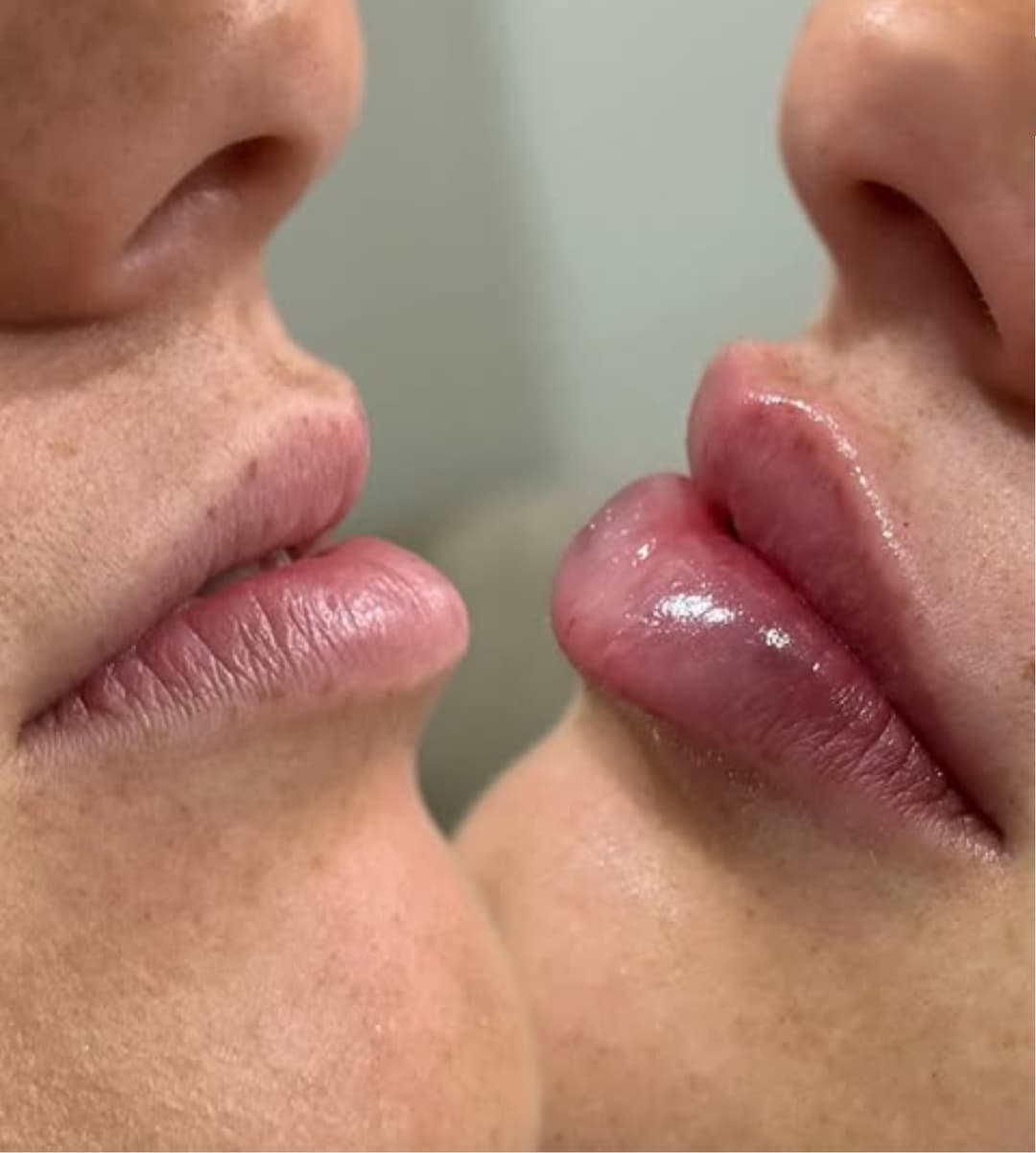 Nega lica i depilacija — LAEL Beauty, Mladenovac, fotografija 2