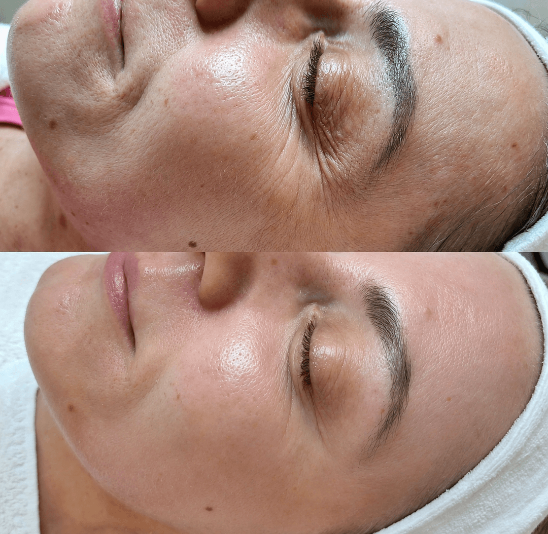 Nega lica i depilacija — LAEL Beauty, Mladenovac, fotografija 6