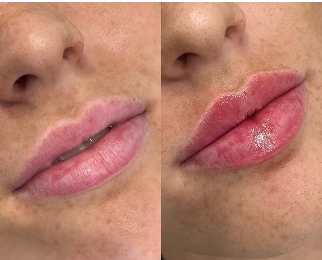 Nega lica i depilacija — LAEL Beauty, Mladenovac