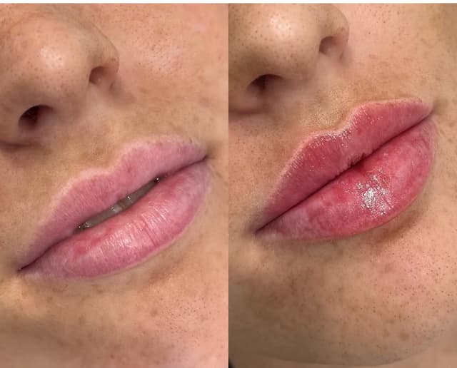 Nega lica i depilacija — LAEL Beauty, Mladenovac