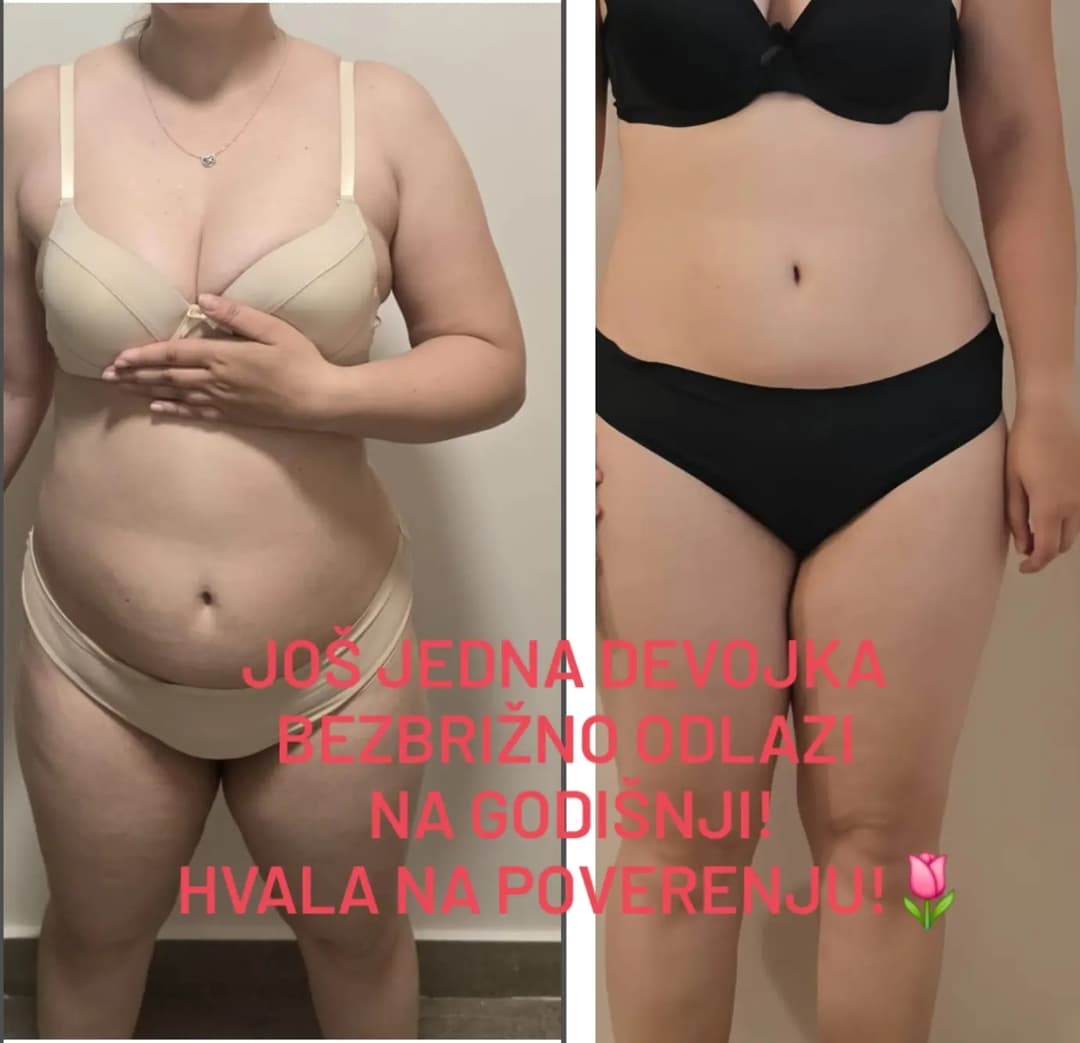 Nega lica i depilacija — LAEL Beauty, Mladenovac, fotografija 14