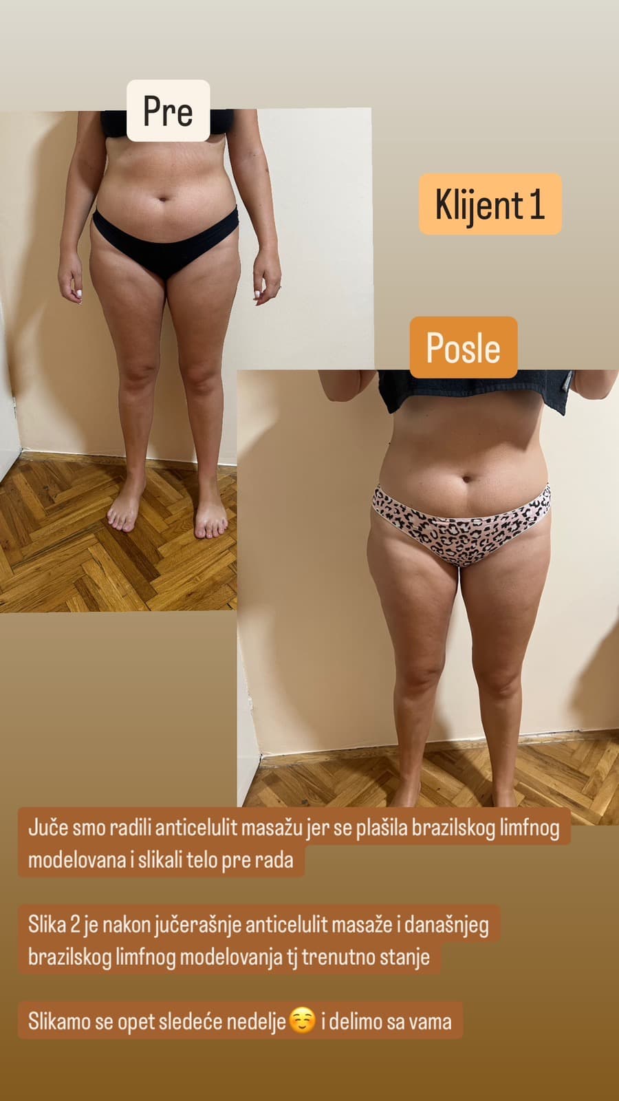 Masaža i tretmani tela — Zgodnica, Banjica, fotografija 12
